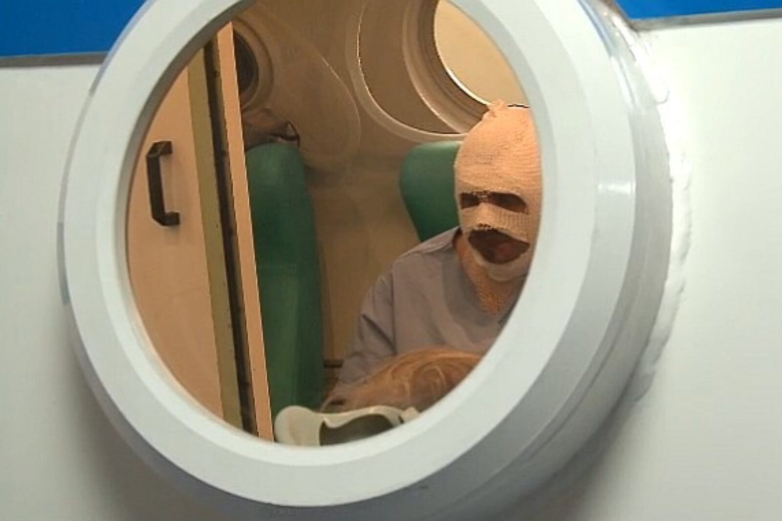 Clo komora hiperbaryczna siemanowice TVS